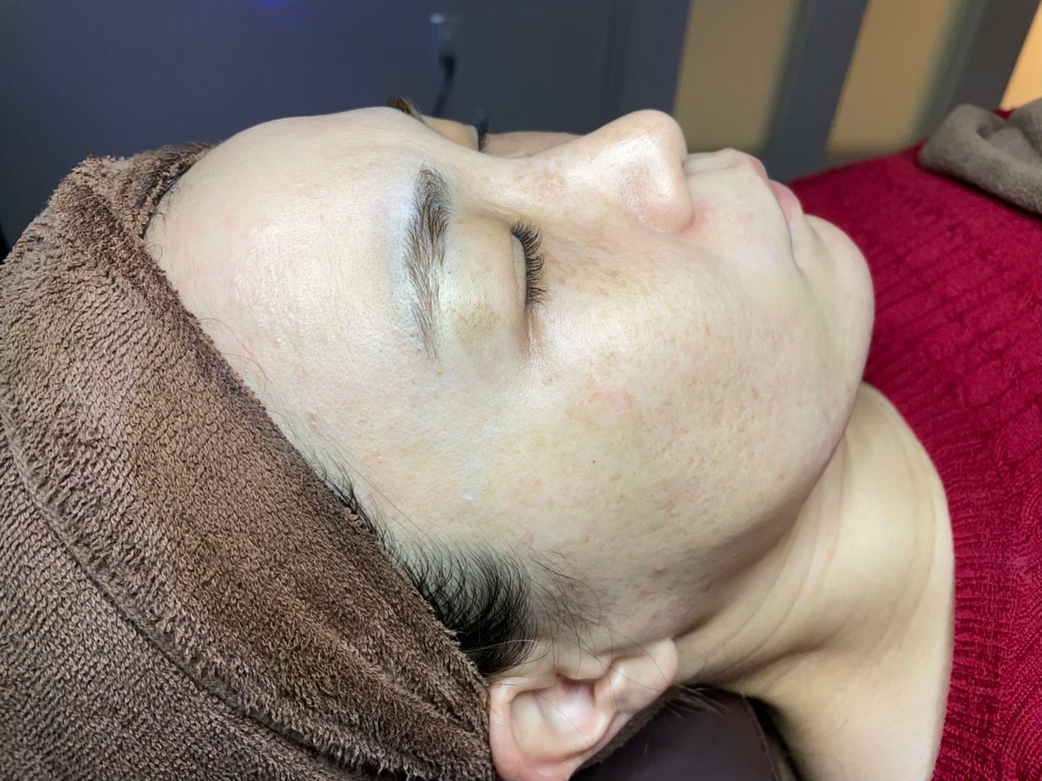 Kさん（30代 ・9回） After