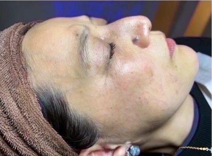 Mさん（50代 ・18回） Before