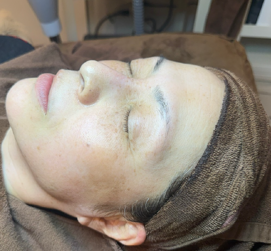 Yさん（50代 ・8回） After